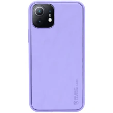 Аксесуар для смартфона Epik Xshield Case Dasheen для Xiaomi Mi 11 Lite: Сумісність Xiaomi Mi 11 Lite