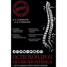 В. А. Єпіфанов, А. В. Єпіфанов: Остеохондроз хребта: Виробник Эксмо
