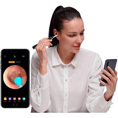 Умная ушная палочка Bebird E3 SE (With Mouth & Mouth Check function) E003.ZJ.00.2907 фото 5