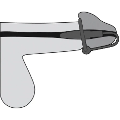 Стимулятор уретри Orion Penis Plug + Silicone Glans Ring Dilator