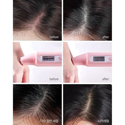 Esthetic House CP-1 Scalp Calming Cica Serum Сыворотка для кожи головы успокаивающая Центелла 20х20 ml: Назначение Увлажнение
