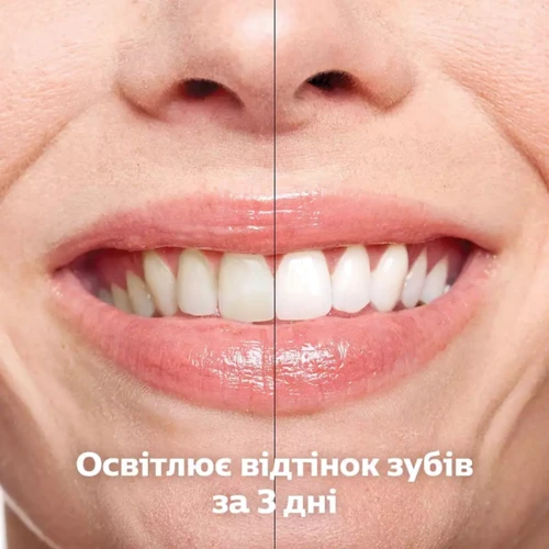 Зубная щетка Набор из 2-х электрических зубных щеток Philips Sonicare DiamondClean 9000 Pink&Black HX9914/69
