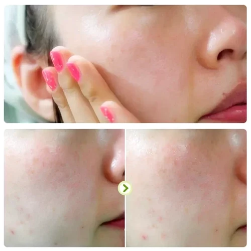 Elizavecca Milky Piggy Galactomyces 100% Pure Ample Ампульная сыворотка с экстрактом галактомисис 50 ml: Тип кожи Все типы кожи