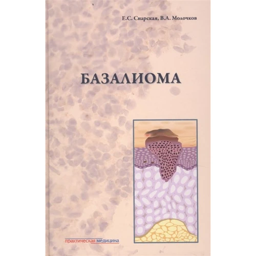 Е. С. Снарская, В. А. Молочков: Базалиома