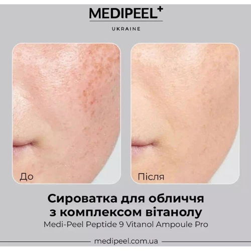 Medi-Peel Peptide 9 Vitanol Ampoule Pro Сыворотка с комплексом 9 пептидов и 20% ниацинамида 30 ml: Пол Для женщин