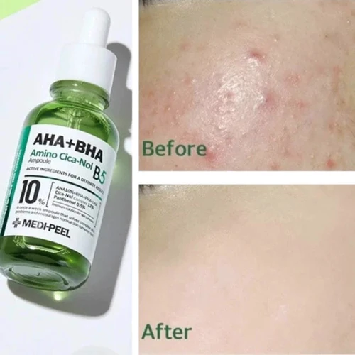 Medi-Peel AHA BHA Amino Cica-Nol B5 Ampoule Сыворотка для лица 30 ml: Назначение Увлажнение, Против воспалений, От раздражения, Восстановление, Сужение пор