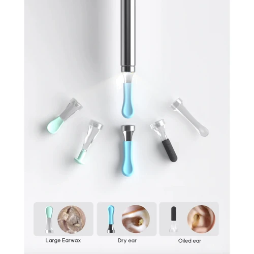 Розумна вушна паличка Bebird R1 Ultra Ear Cleaner Black фото 6