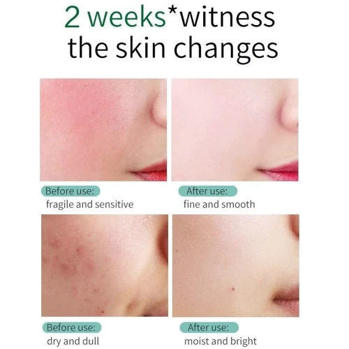 Skin Ever Centella Відновлювальний крем для обличчя з центелою 30 ml: Час застосування Универсальный