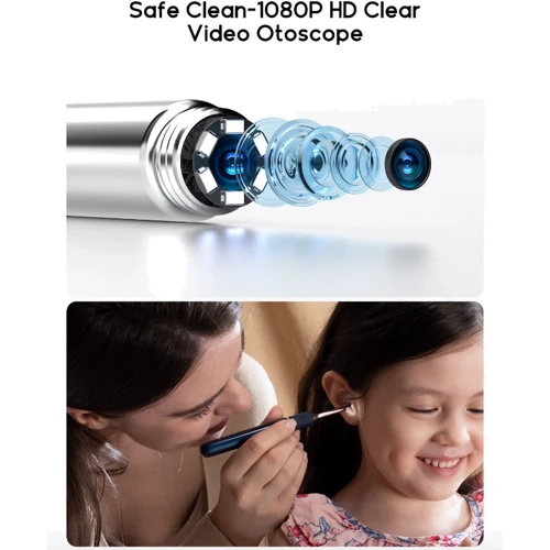 Розумна вушна паличка Bebird Note5 Pro Versatile Ear Cleaner Blue фото 3