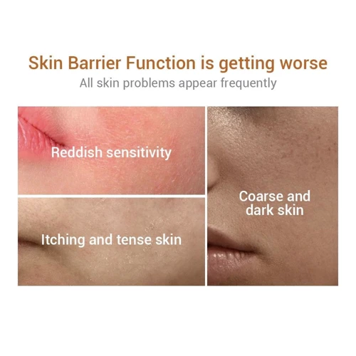 Lanbena Ectoin Soothing Serum Успокаивающая сыворотка для чувствительной кожи с эктоином 30 ml: Классификация Мидл-маркет