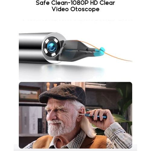 Розумна вушна паличка Bebird Note5 Pro Versatile Ear Cleaner Blue: Тип Ушная палочка