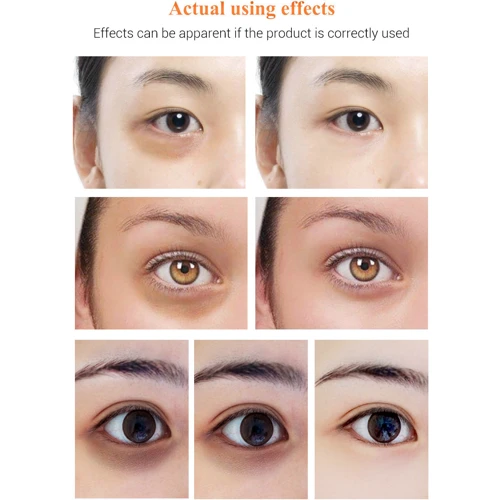 Lanbena Vitamin C Eye Serum Осветляющая сыворотка для кожи вокруг глаз с витамином С 20 g: Вес, г 20