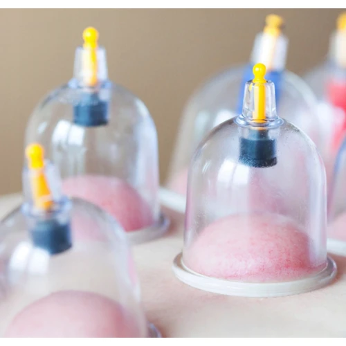 Массажер 4FIZJO Вакуумные массажные банки для тела (китайские/атницелюлитные банки) 24 шт с помпой (P-5907739319913)