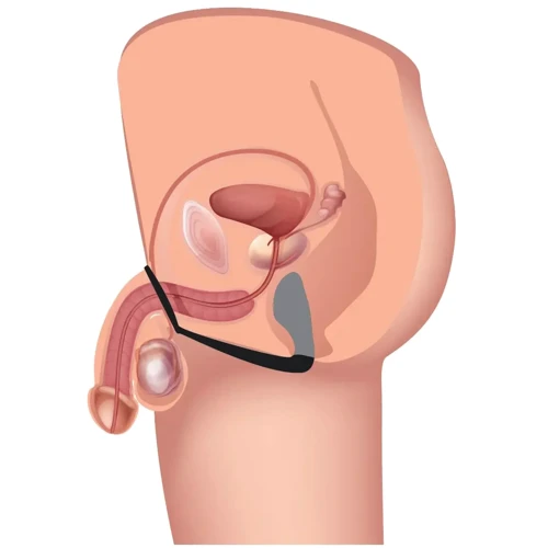 Стимулятор простаты Prostatic Play Explorer II Prostate Stimulator And Cock Ring (черный)
