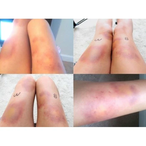 Mehron ProColoRing™ Bruise Палитра для имитации синяков и гематом 30 g фото 1