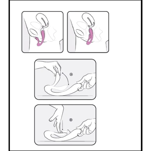 Вибратор Femintimate Dual Massager