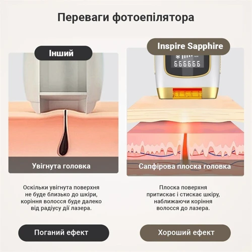 Фотоэпилятор Inspire Sapphire XM-L011G фото 4