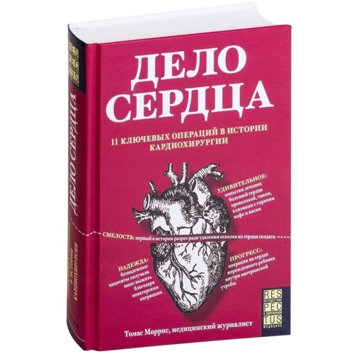 Томас Моррис: Дело сердца. 11 ключевых операций в истории кардиохирургии фото 7