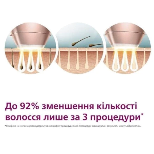 Фотоэпилятор Philips Lumea IPL 9900 Series Hair removal with SenseIQ BRP958/00 фото 2
