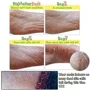 Elizavecca Witch Piggy Hell-Pore Turtles Foot Pack Отшелушивающая маска-носочки для ног фото 4