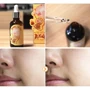 Elizavecca Witch Piggy Hell-Pore Bifida Pure Ample 50 ml Восстанавливающая сыворотка на основе лизата бифидобактерий: Время применения Универсальный