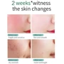 Skin Ever Centella Відновлювальний крем для обличчя з центелою 30 ml: Час застосування Универсальный