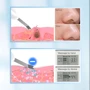 Ультразвуковий скрабер TOUCHBeauty Ultrasonic Beauty Device для очищення шкіри TB-1887A фото 6