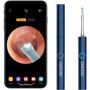 Умная ушная палочка Bebird E3 SE (With Mouth & Mouth Check function) E003.ZJ.00.2907 фото 7