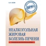 Олена Вовк: Неалкогольна жирова хвороба печінки