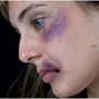 Mehron Tri-Color Makeup Palette (Bruise) Набор кремового грима для образа "Синяки и ушибы" 7oz., 20 g фото 2