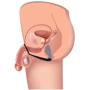 Стимулятор простаты Prostatic Play Explorer II Prostate Stimulator And Cock Ring (черный)
