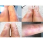 Mehron ProColoRing™ Bruise Палитра для имитации синяков и гематом 30 g фото 1