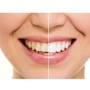 Зубна щітка Medica+ Probrush 9.0 (Ultasonic) Fuchsia (MD-102976): Призначення универсальная