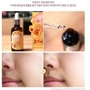 Elizavecca Milky Piggy Bifida 100% Антивозрастная сыворотка для лица 50 ml фото 7